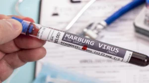 تحذير عاجل: السفارة بسبب انتشار فيروس ماربورغ ف السعودية في إثيوبيا تنبّه المواطنيني جنوب أومو